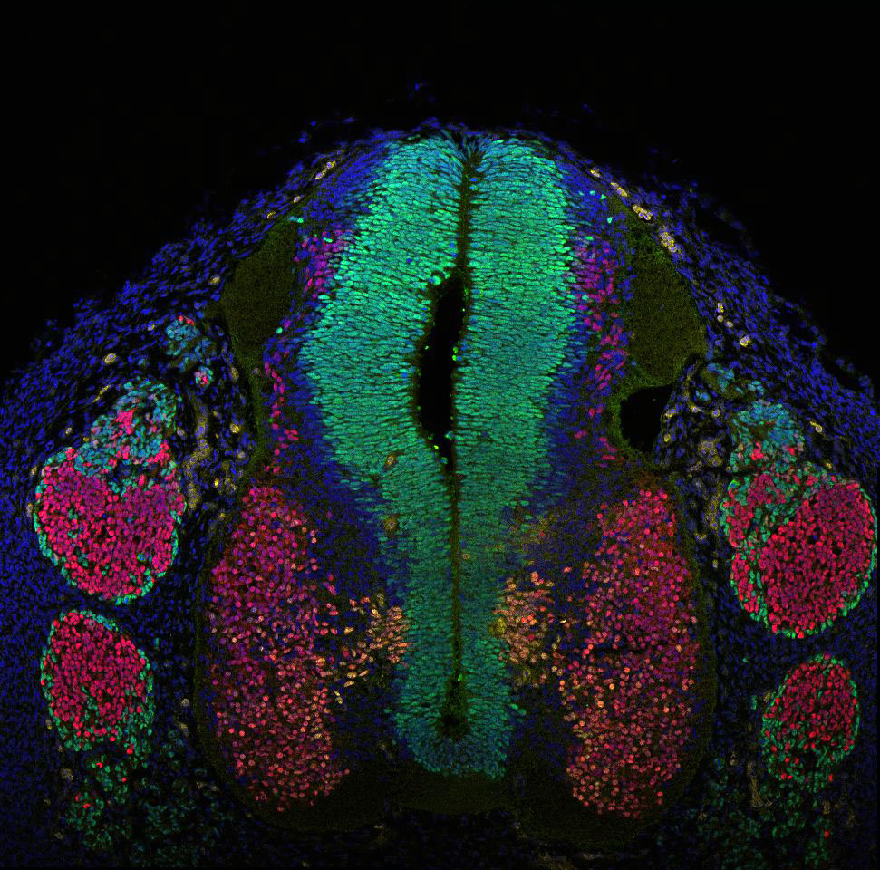 Gene expression in the human embryonic spinal cord