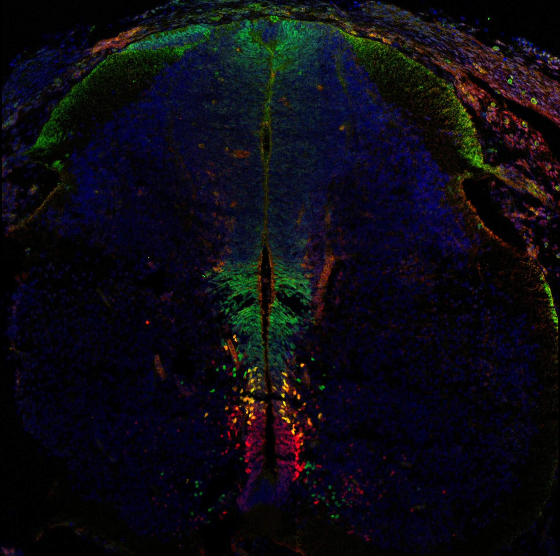 Gene expression in the human embryonic spinal cord
