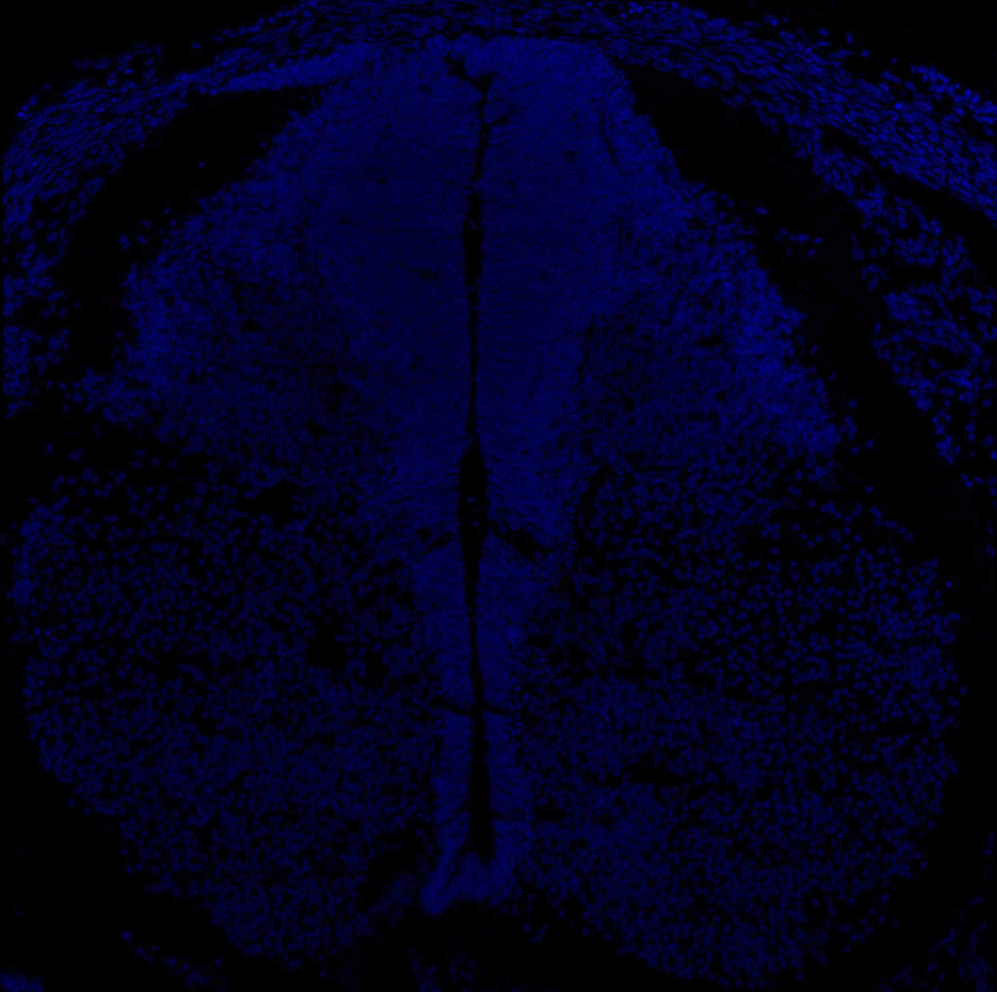 Gene expression in the human embryonic spinal cord