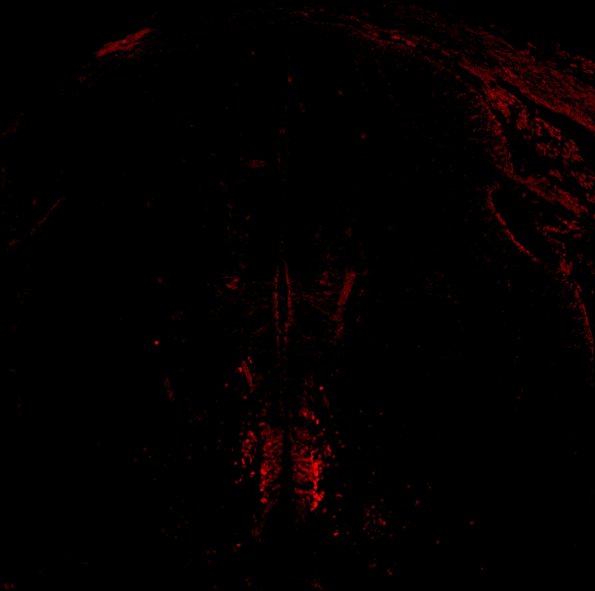 Gene expression in the human embryonic spinal cord