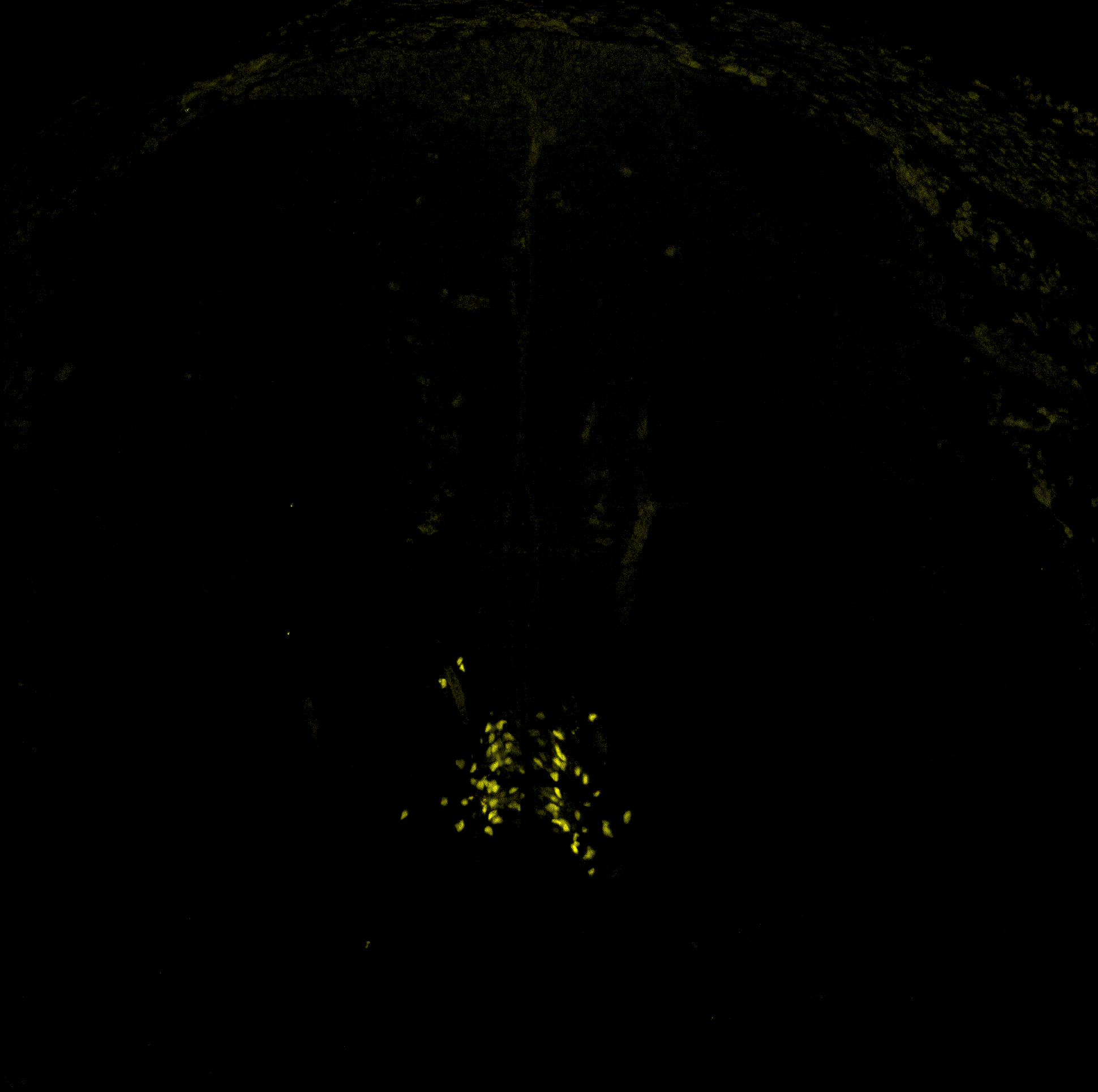 Gene expression in the human embryonic spinal cord