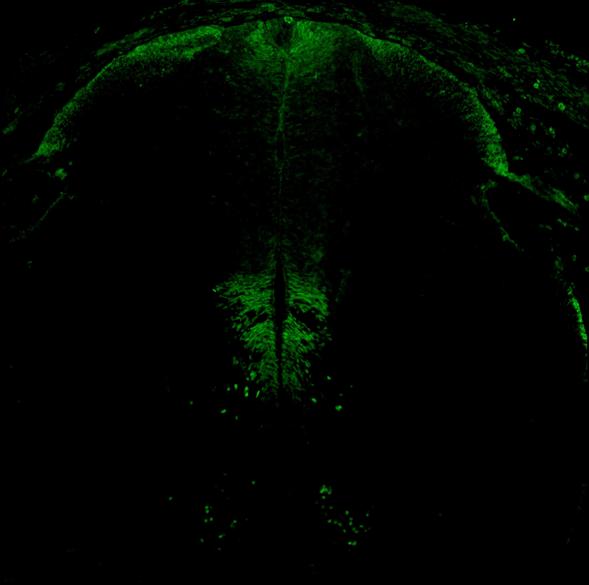 Gene expression in the human embryonic spinal cord