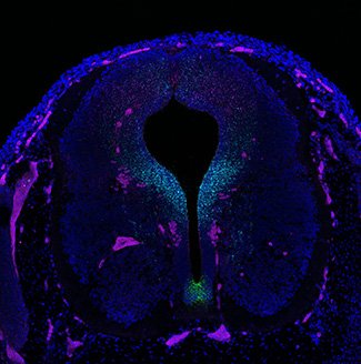 Gene expression in the human embryonic spinal cord