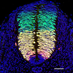Gene expression in the human embryonic spinal cord