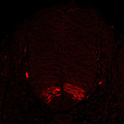 Gene expression in the human embryonic spinal cord