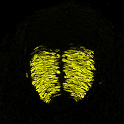 Gene expression in the human embryonic spinal cord