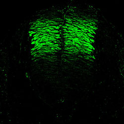 Gene expression in the human embryonic spinal cord