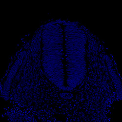 Gene expression in the human embryonic spinal cord