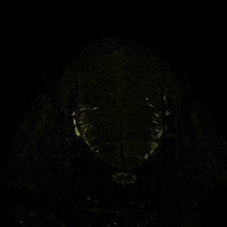 Gene expression in the human embryonic spinal cord
