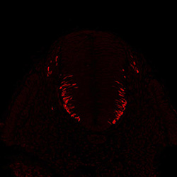 Gene expression in the human embryonic spinal cord