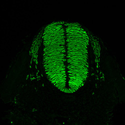 Gene expression in the human embryonic spinal cord