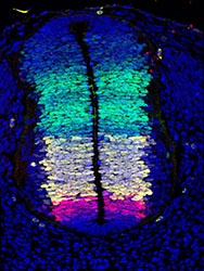 Gene expression in the human embryonic spinal cord