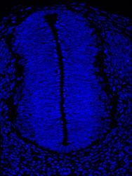 Gene expression in the human embryonic spinal cord