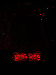 Gene expression in the human embryonic spinal cord