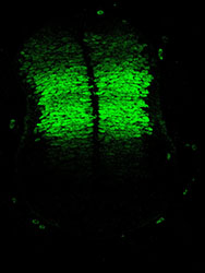 Gene expression in the human embryonic spinal cord