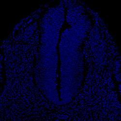 Gene expression in the human embryonic spinal cord
