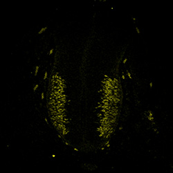 Gene expression in the human embryonic spinal cord