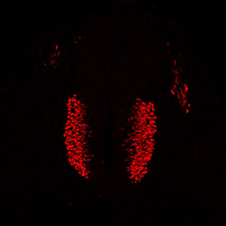 Gene expression in the human embryonic spinal cord