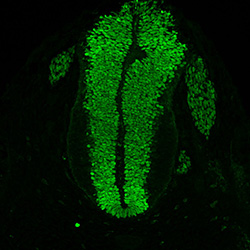 Gene expression in the human embryonic spinal cord
