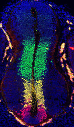 Gene expression in the human embryonic spinal cord
