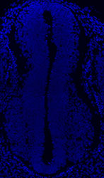Gene expression in the human embryonic spinal cord
