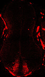 Gene expression in the human embryonic spinal cord