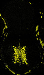 Gene expression in the human embryonic spinal cord