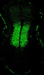 Gene expression in the human embryonic spinal cord