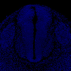 Gene expression in the human embryonic spinal cord
