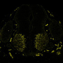 Gene expression in the human embryonic spinal cord