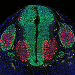 Gene expression in the human embryonic spinal cord