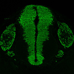 Gene expression in the human embryonic spinal cord