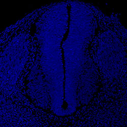 Gene expression in the human embryonic spinal cord