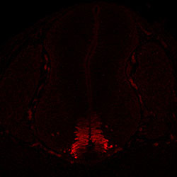 Gene expression in the human embryonic spinal cord
