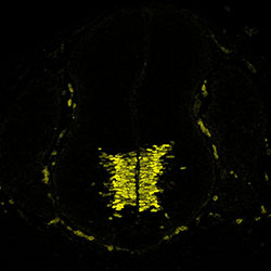 Gene expression in the human embryonic spinal cord