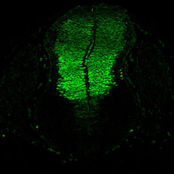 Gene expression in the human embryonic spinal cord