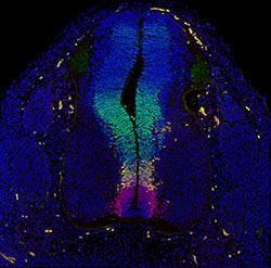 Gene expression in the human embryonic spinal cord