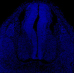 Gene expression in the human embryonic spinal cord