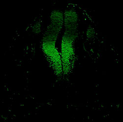 Gene expression in the human embryonic spinal cord