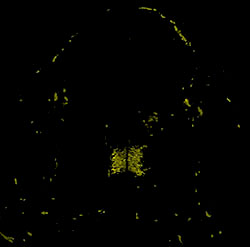 Gene expression in the human embryonic spinal cord