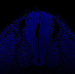 Gene expression in the human embryonic spinal cord