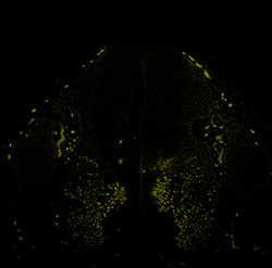 Gene expression in the human embryonic spinal cord