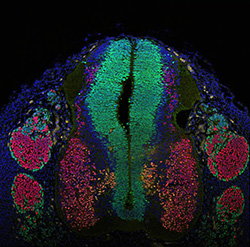 Gene expression in the human embryonic spinal cord