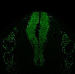 Gene expression in the human embryonic spinal cord