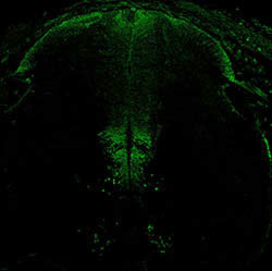 Gene expression in the human embryonic spinal cord