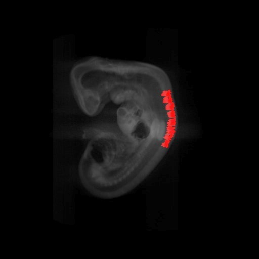 A 3D model of a human embryo