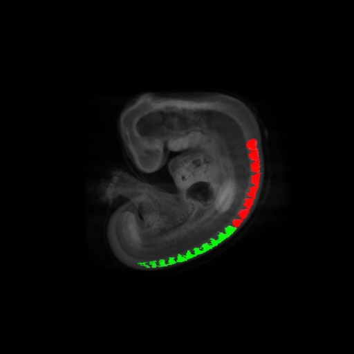 A 3D model of a human embryo