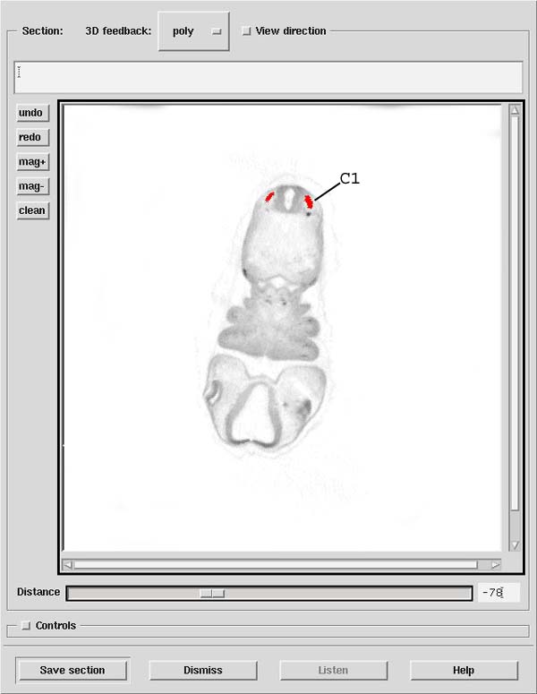 A 3D model of a human embryo