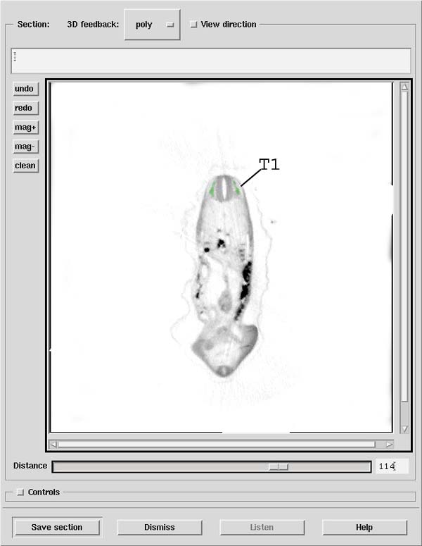 A 3D model of a human embryo
