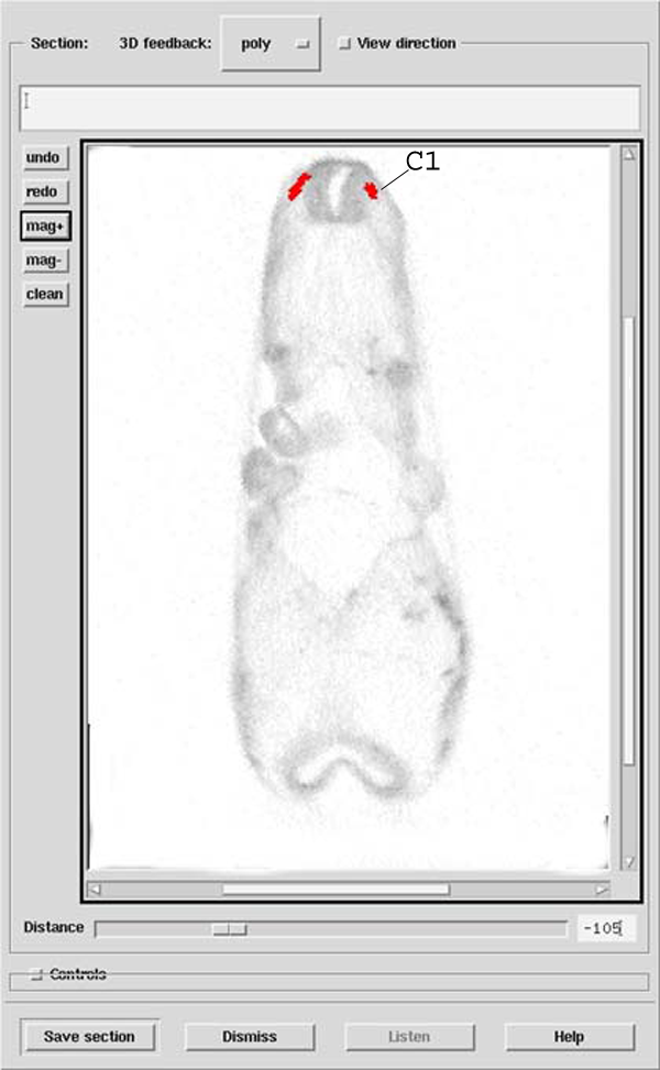 A 3D model of a human embryo